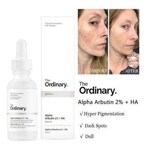 The Ordinary - Alpha Arbutin 2% + HA