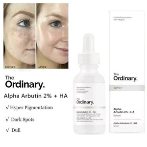 The Ordinary - Alpha Arbutin 2% + HA