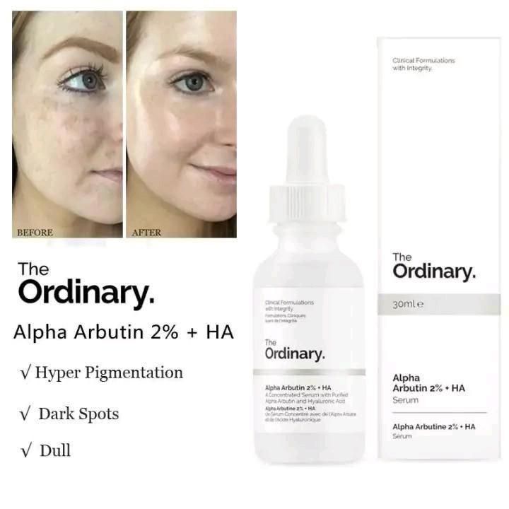 The Ordinary - Alpha Arbutin 2% + HA